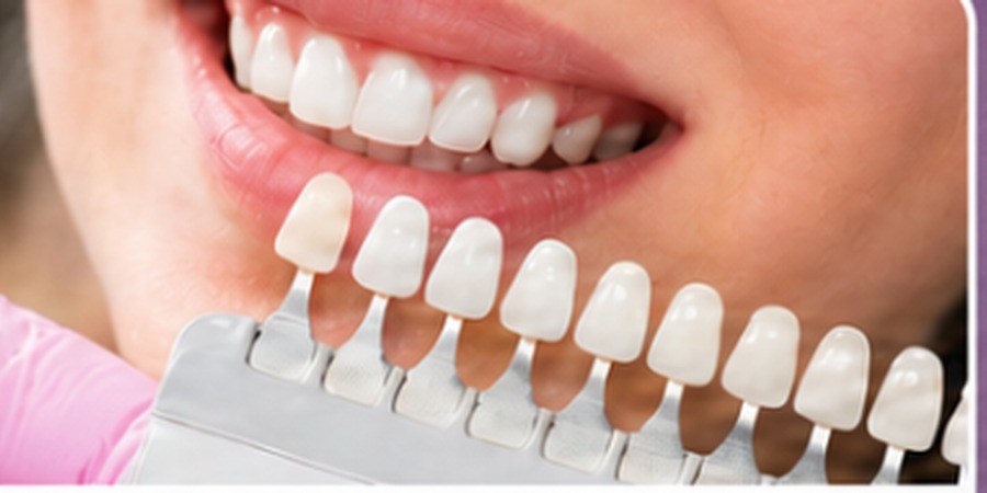 Estética dental
